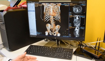  Томограф, флюорограф, маммограф и рентген-аппарат помогут в лечении галичан