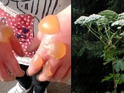 Боремся с опасным растением